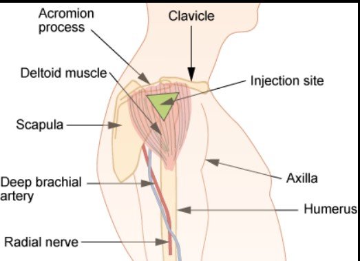 IM Injection